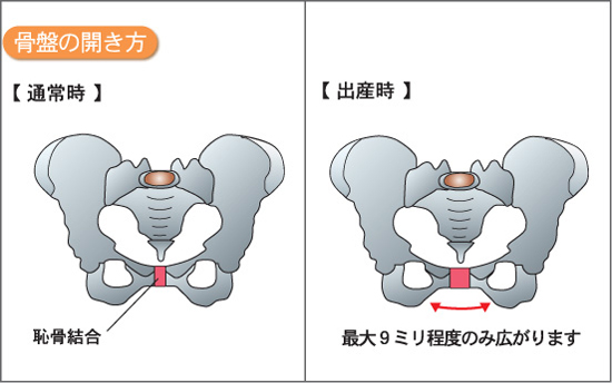 産後骨盤